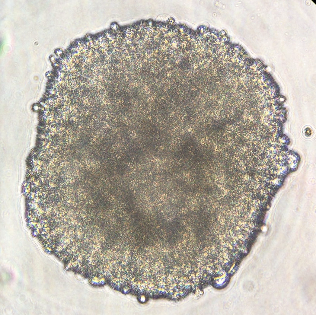 jsc2022e083018 (10/26/2022) — A preflight image of beating cardiac spheroid composed of iPSC-derived cardiomyocytes (CMs), endothelial cells (ECs), and cardiac fibroblasts (CFs). These cells are incubated and put under the microscope in space as part of the Effect of Microgravity on Drug Responses Using Heart Organoids (Cardinal Heart 2.0) investigation. Image courtesy of Drs. Joseph Wu, Dilip Thomas and Xu Cao, Stanford Cardiovascular Institute